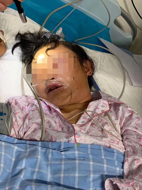 【围观】毒蛇不冬眠？泸州2人被偷袭入院……(图4)