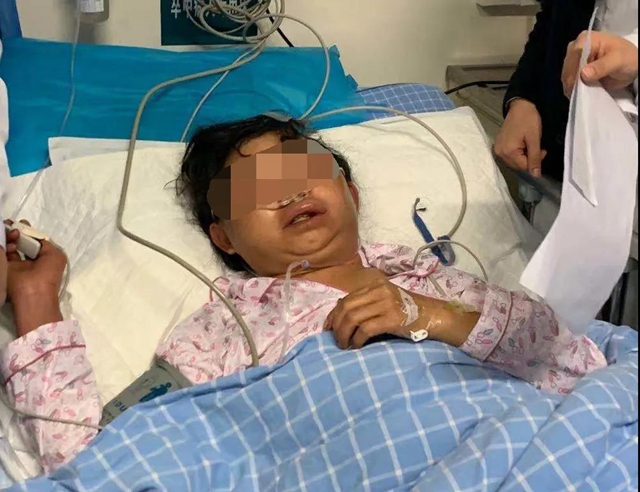 【围观】毒蛇不冬眠？泸州2人被偷袭入院……(图5)