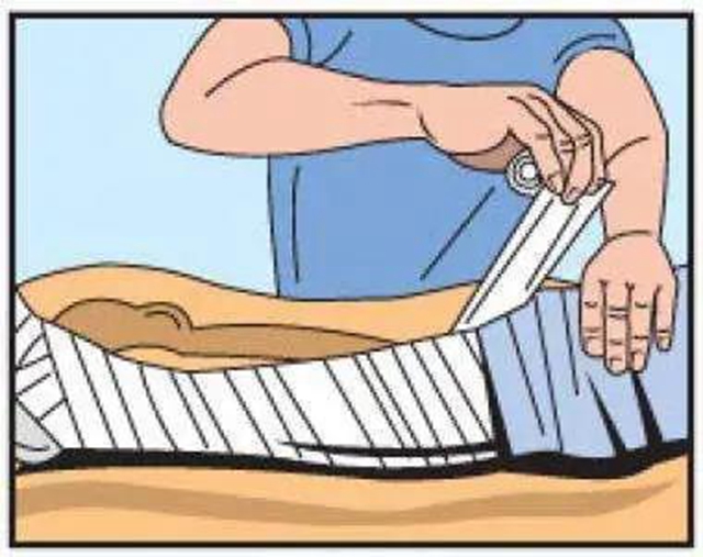 【围观】毒蛇不冬眠？泸州2人被偷袭入院……(图10)