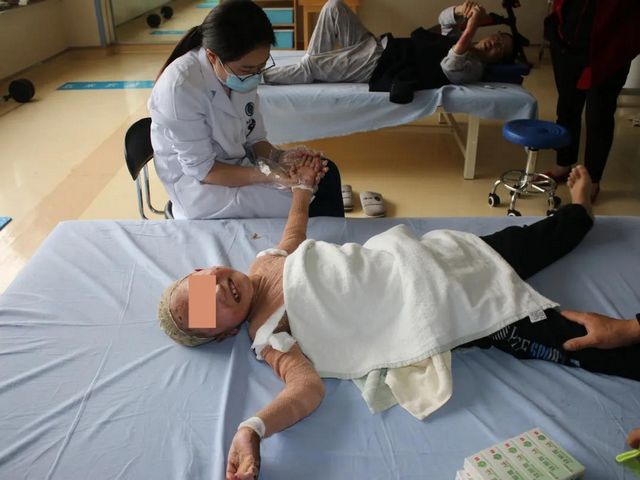 哥哥严重烧伤，7岁双胞胎弟弟捐头部皮肤不叫一声疼！(图8)