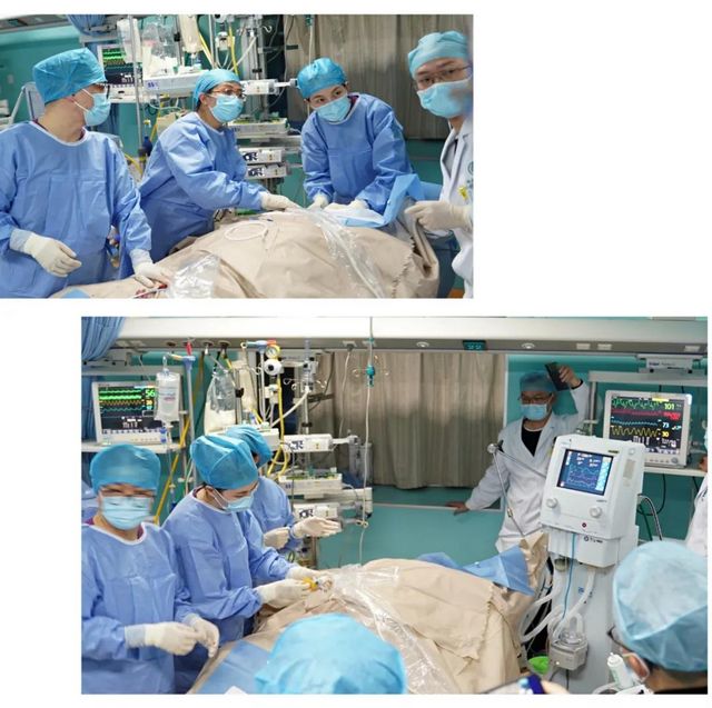 首例！救命的硬核武器—ECMO技术在西南医大附院成功开展(图4)