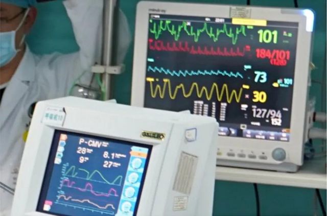 首例！救命的硬核武器—ECMO技术在西南医大附院成功开展(图3)