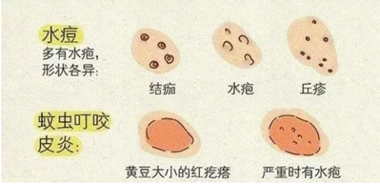 川南学生家长速看：当前已进入水痘高发期！(图4)