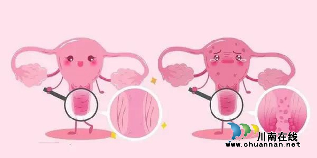【关注】晚期卵巢癌患者遇见男神毛教授会怎样？(图9)