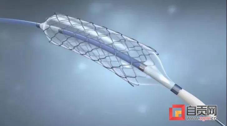 “百元级”冠脉支架落地自贡 全市6家三级医院均有采购(图1)