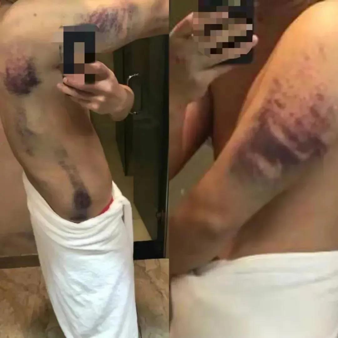 泸州两男子偷渡去缅甸打工，身陷诈骗团伙遭毒打(图6)