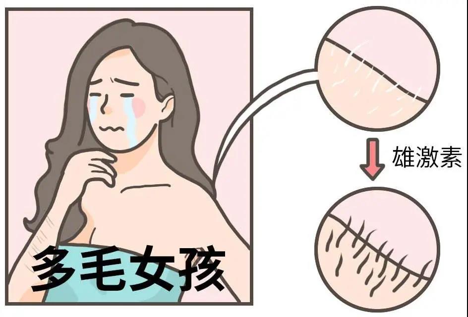 【提醒】女性多毛、月经紊乱、痤疮，当心得了这个病！(图6)