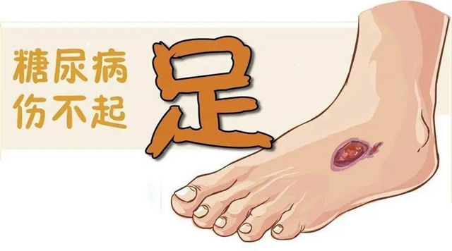 【扩散】脚指甲剪很短，感觉很爽？！代价却很……(图4)