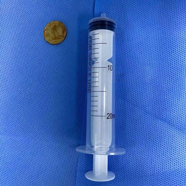 【惊险】泸州3岁熊孩子吞下硬币,帅气男医生跪地取出!(图6) 【惊险】泸州3岁熊孩子吞下硬币,帅气男医生跪地取出!(图6)