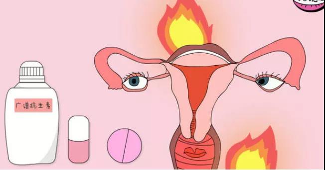【关注】女性私处千万别过度清洁，可能会……(图5)