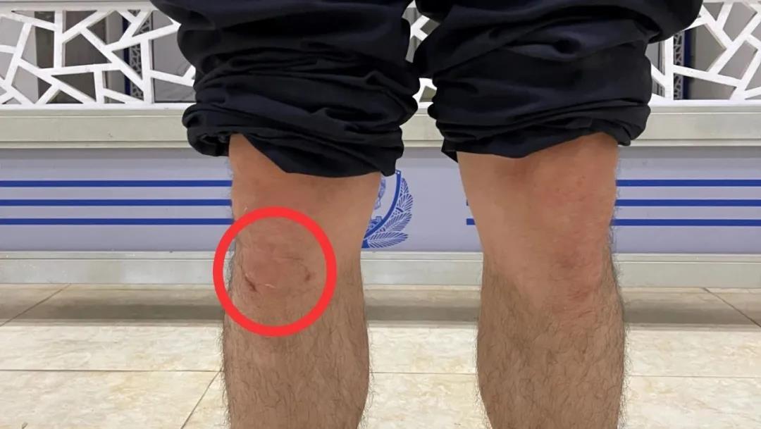 “袭警罪”不是说说而已!泸州两人以身试法已被刑拘!(图8) “袭警罪”不是说说而已!泸州两人以身试法已被刑拘!(图8)