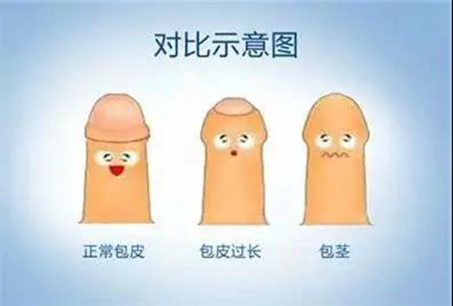 【围观】真猛！男子竟自己割包皮？(图11)