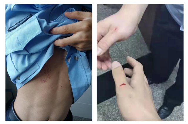 泸州女子打完警察，说“让我上新闻”……必须安排！(图3)