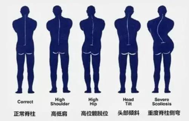 【扩散】泸州12岁男孩为何突然长高3公分？(图11)