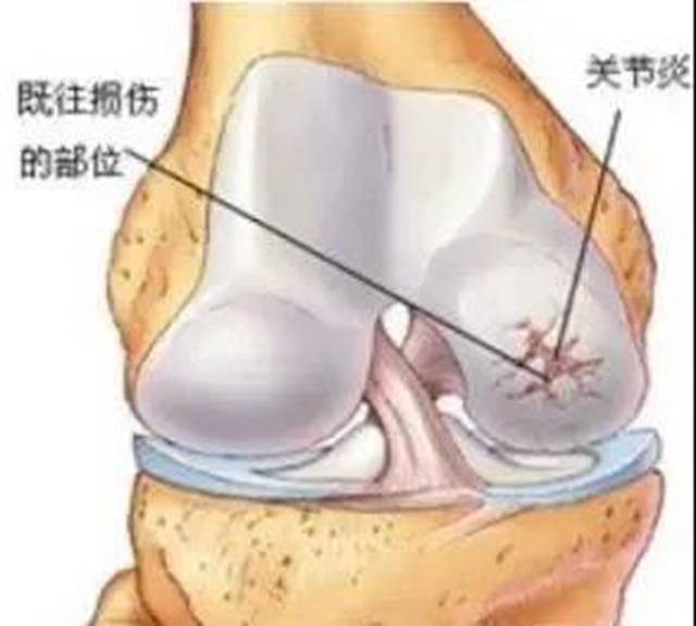 【提醒】天凉时如何保护关节？(图4)