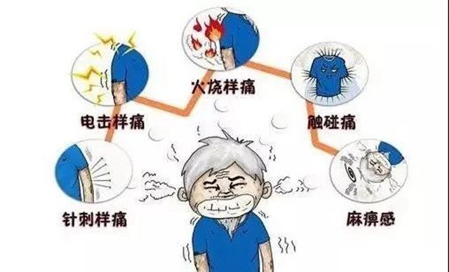 两月“缠腰丹”fēi痛，一夕微创术治愈(图3)
