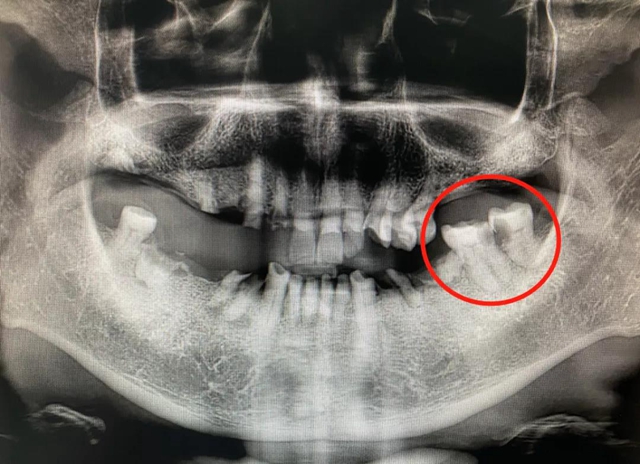 【围观】两夜未眠，泸州90岁老人连夜做了这事？(图3)