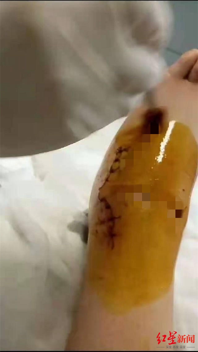 泸州合江一女生被体罚150个下蹲 学生家长：已收到学校补偿款39万元(图2)