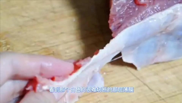 52岁大哥饿了想吐竟是肠癌 、81岁大爷70余刀挽回性命……这件事太重要！(图9)