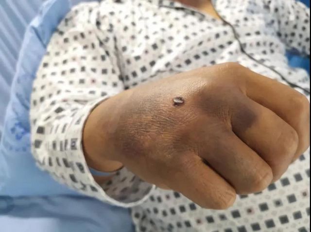 13人惨遭意外袭击，如果你遇到了要这样自救(图1)