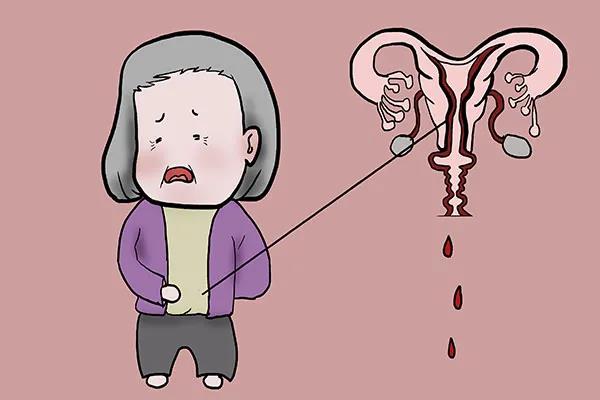 【扩散】88岁老奶奶下体掉了块“肉”?(图5) 【扩散】88岁老奶奶下体掉了块“肉”?(图5)