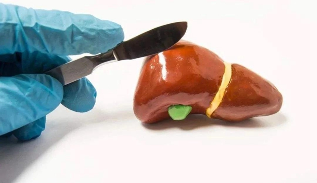 【警惕】身体里的这个“肉疙瘩”，6种情况不切除，当心癌变！(图7)
