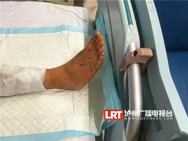 18人被咬伤住院！“烙铁头”出没，泸州人小心(图1)