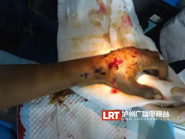 18人被咬伤住院！“烙铁头”出没，泸州人小心(图4)