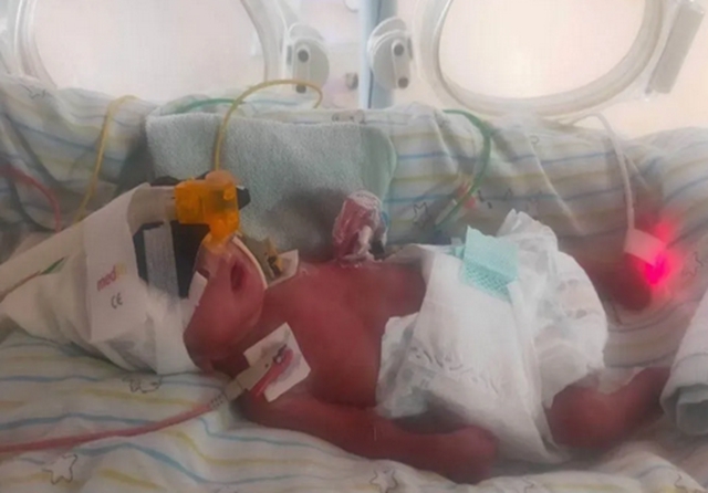 【围观】出生时仅2斤，又一“巴掌宝宝”闯关成功(图3)