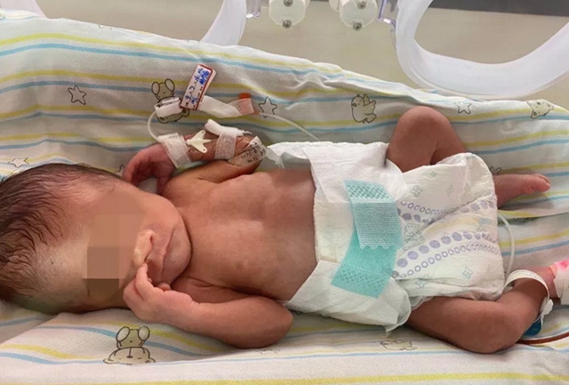 【围观】出生时仅2斤，又一“巴掌宝宝”闯关成功(图5)