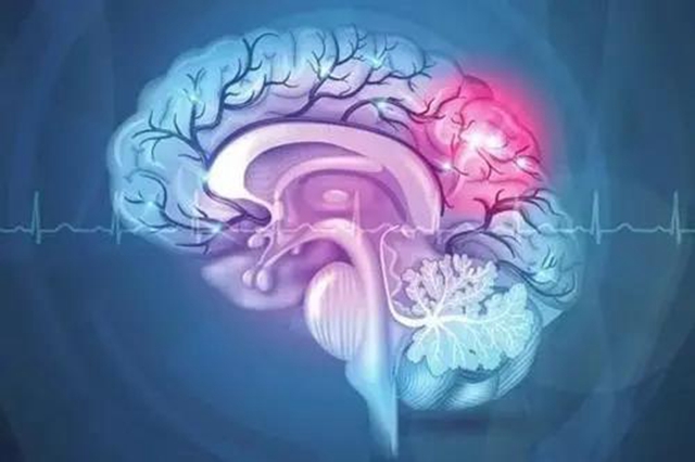 【提醒】身体出现这3个症状,小心脑卒中!(图7) 【提醒】身体出现这3个症状,小心脑卒中!(图7)