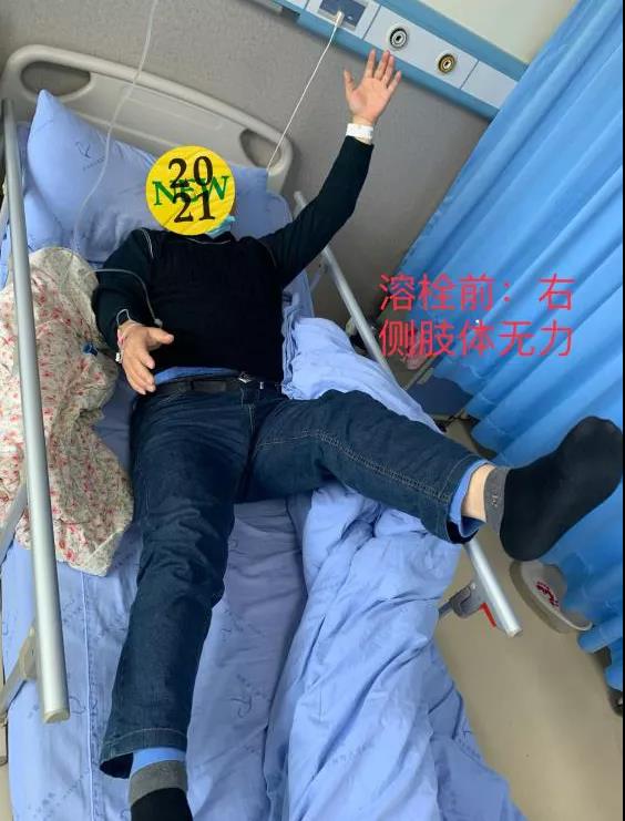 转发可以救命！中风急救，抓住黄金4.5小时