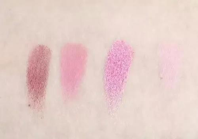 【真相】核磁共振没有辐射!你信吗?(图7) 【真相】核磁共振没有辐射!你信吗?(图7)