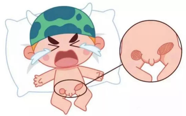 【扩散】孩子哭闹后大腿根鼓个包？居然是……(图1)