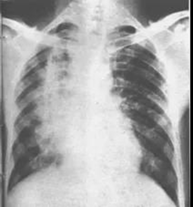 所有的肿瘤患者都需要放疗吗？(图7)