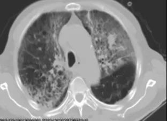 所有的肿瘤患者都需要放疗吗？(图8)