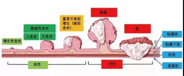 人只要活着都会得癌症吗？ 谈癌色变不如提早预防！(图3)