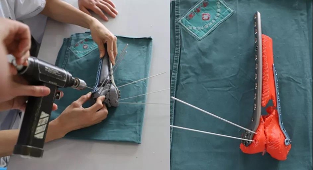 【危险】50岁大叔高处摔下，差点……(图3)