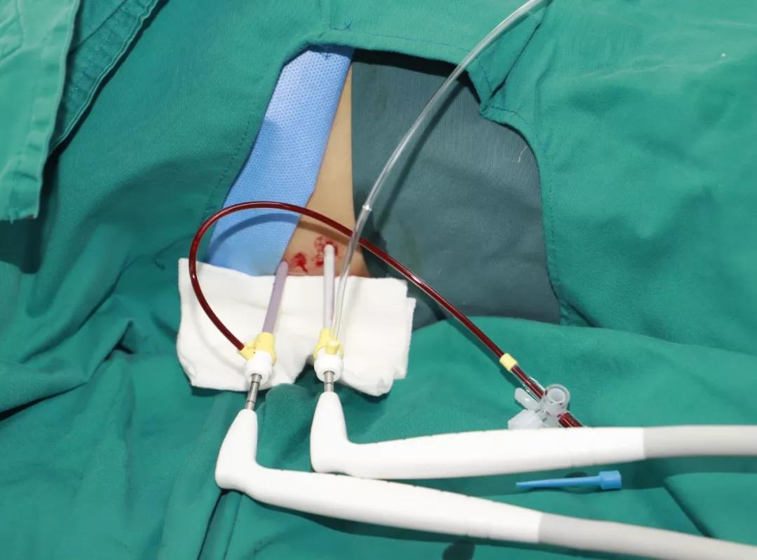 【扩散】肝癌患者请注意,西南医大中医院可免费治疗!(图9) 【扩散】肝癌患者请注意,西南医大中医院可免费治疗!(图9)