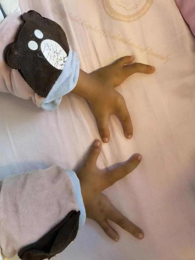 孩子分开的手指终于合上了，父亲笑了！(图2)