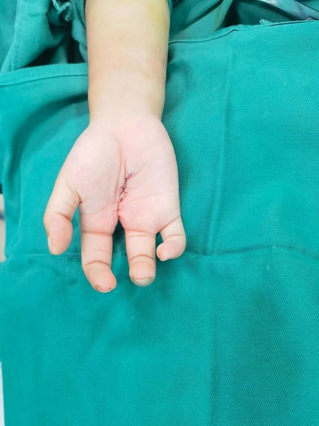 孩子分开的手指终于合上了，父亲笑了！(图7)