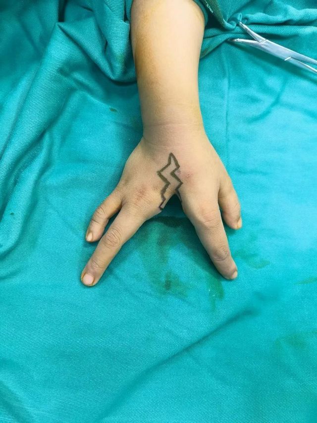 孩子分开的手指终于合上了，父亲笑了！(图5)