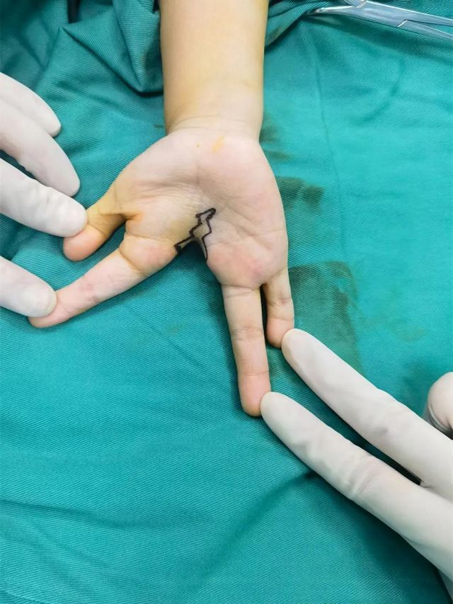 孩子分开的手指终于合上了，父亲笑了！(图4)