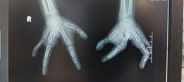 孩子分开的手指终于合上了，父亲笑了！(图3)