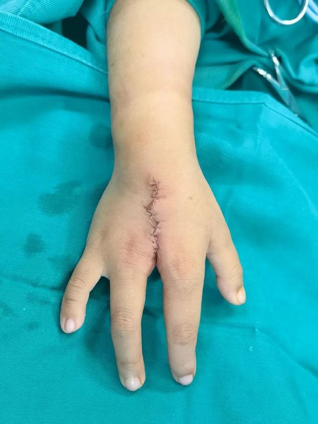 孩子分开的手指终于合上了，父亲笑了！(图6)