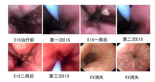 【注意】脾胃·风湿免疫病科有新家了！(图10)