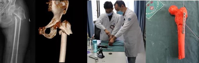 【惊险】6人摔得“粉身碎骨”？(图6)