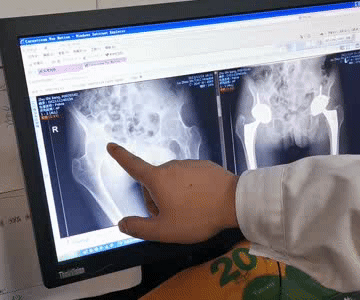 深受病痛折磨20年 一朝圆了“行走梦”(图3)