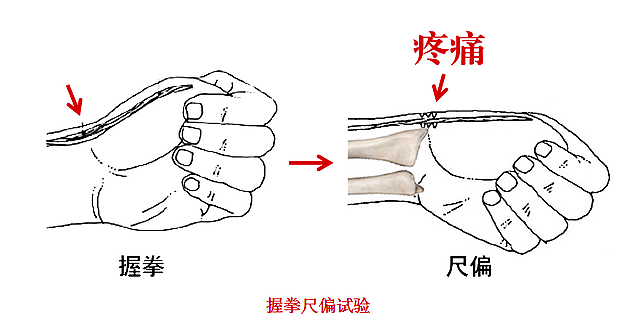 【围观】半夜,床上“咔噔”一声……(图3) nEO_IMG_2.jpg