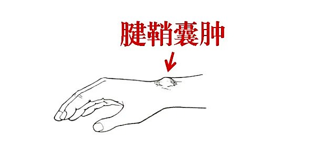 【围观】半夜,床上“咔噔”一声……(图4) nEO_IMG_3.jpg